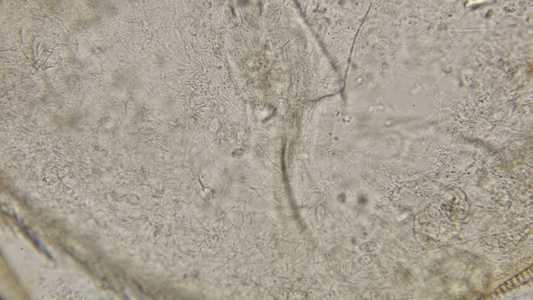 Colony of Bacteria Spirochetes Under a Microscope alt