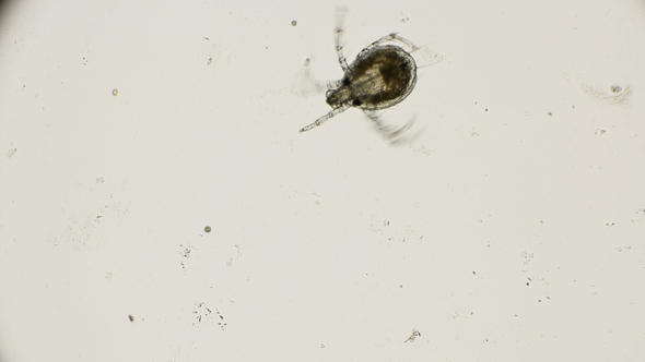 Water Mite in Motion, Under a Microscope