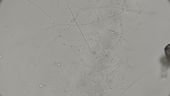 Colony of Bacteria Spirochetes Under a Microscope