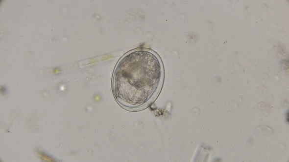 Egg Rotatoria Ready To Hatch, Under a Microscope