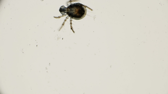 Water Mite in Motion, Under a Microscope