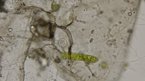 Planktonic Ciliate Halteria Rubra Under a Microscope