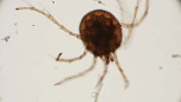 Water Mite Moving Legs Under a Microscope