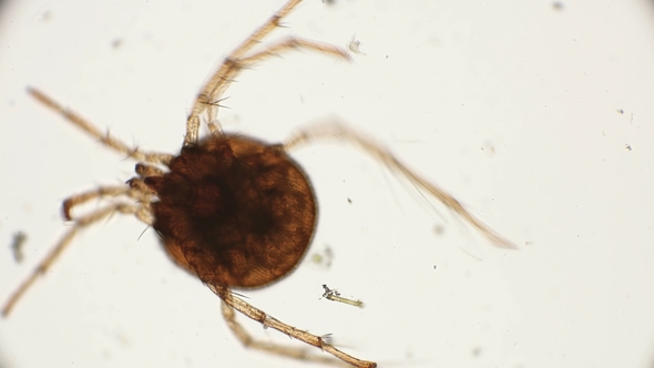 Water Mite Moving Legs Under a Microscope