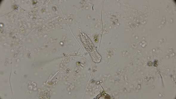 Brûhoresničnye Worms Gastrotricha Under the Microscope