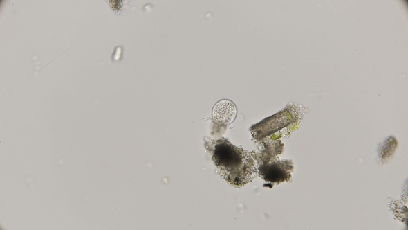 Planktonic Ciliate Halteria Rubra Under a Microscope