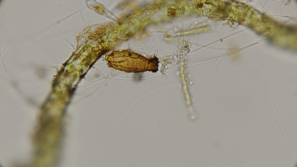 Peritricha Species Infusoria, Pyxicola Class, Under a Microscope