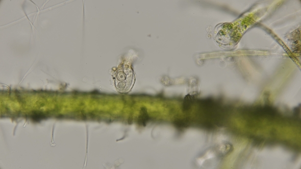Infusoria Species Peritricha in the Sink Which Got Halteria Rubra, Under a Microscope