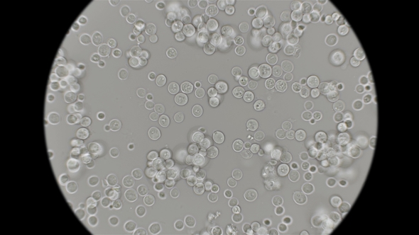 Yeast Is Moving Under the Microscope