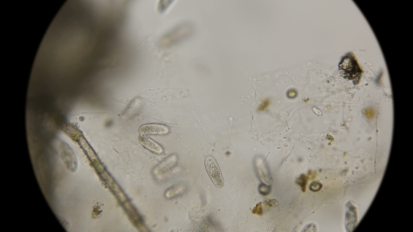 Colony of Paramecium Infusoria, Among Which Are Ready To Divide, Under the Microscope alt