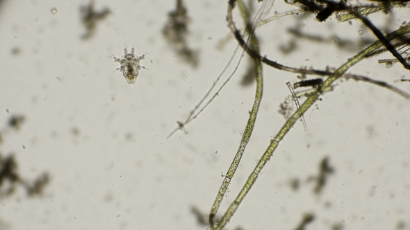 The Cyclops Nauplius Together with the Variety of Microorganisms of the Pond Under the Microscope