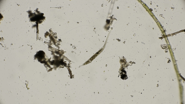 Dileptus in Search of Food Under a Microscope alt