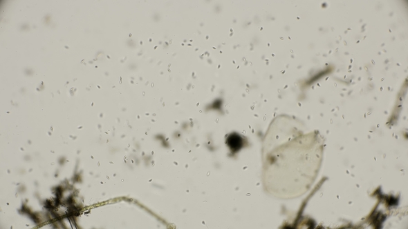 a Colony of Ciliates Paramecium, Fast-moving, Under a Microscope alt