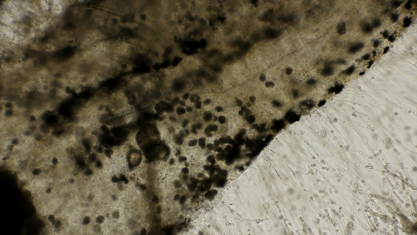 in the Dead Fish Bred Colonies Tetrahymena, Water Fungi Mold Saprolegnia and Other Parasites That alt