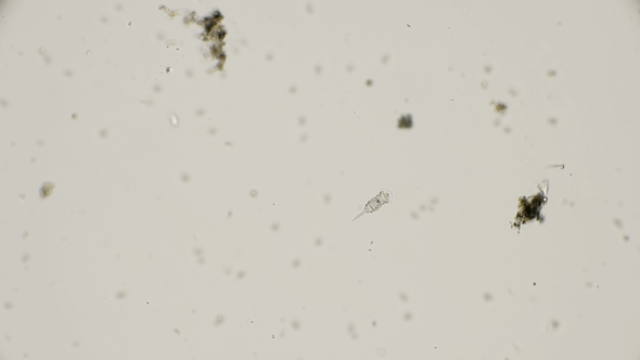 Squatinella Mutica Rotifer in Motion, Under the Microscope