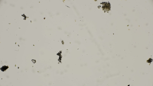 Amphileptus Infusoria in Motion Looking for Food Under a Microscope alt