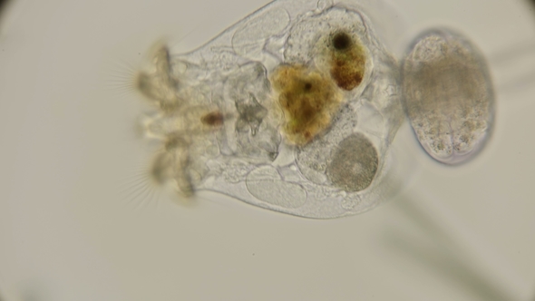 Brachionus Plicatilis Rotifer, How It Feeds and How Microorganisms Get Into Her Stomach, a Good