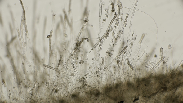 in the Dead Fish Started , the Water Molds Saprolegnia and Other Parasites That Feed on the Flesh alt