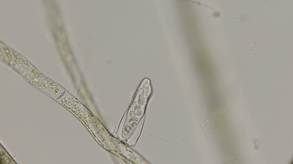 Ciliate Species of Peritricha in the Sink , Under a Microscope
