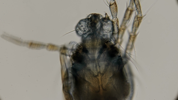 Hydrachnidia Under a Microscope, You Can See How His Jaw, Quite Scary