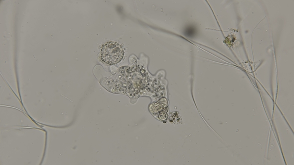 the Amoeba Parasite in Motion, Under a Microscope