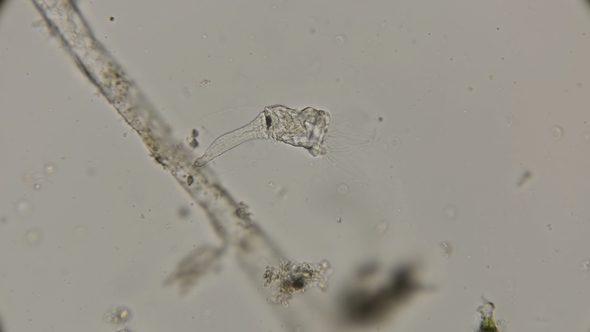 Infusoria Class Acineta with Cilia, Under a Microscope