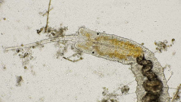 Worm of the Family Naididae Pristina Longiseta Under the Microscope