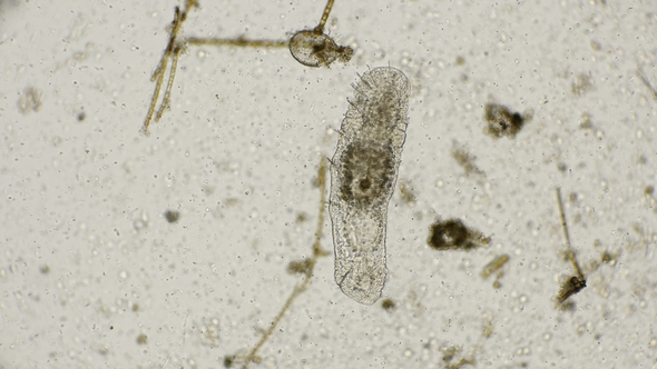 the Worm Species of Oligochaeta, Aeolosomatidae Family Under the Microscope