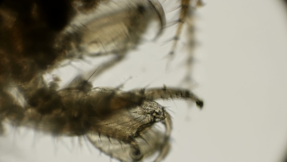 the Work of the Front Leg of Gammarus - Like Hooks Under a Microscope