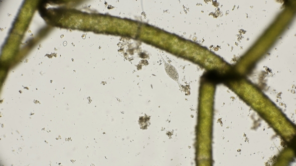 Litonotus Infusoria Under a Microscope