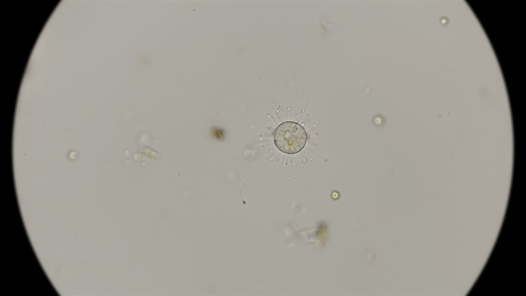 Infusoria Podophrya Under a Microscope