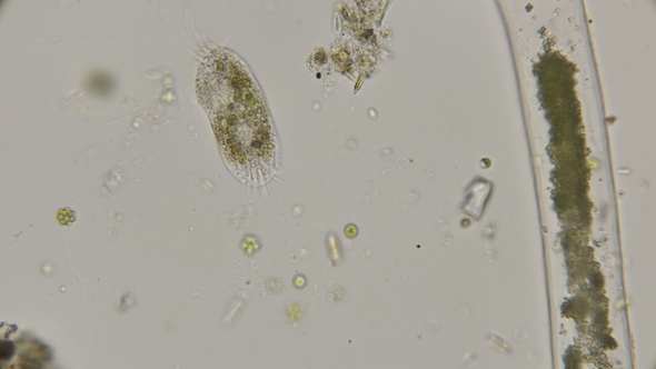 Infusoria Stylonychia Under the Microscope