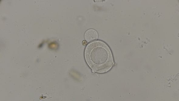 Bell-shaped Ciliates Vorticella Free Swimming Under a Microscope