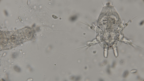 Rotifera Philodina and Near Nauplius Cyclops Under a Microscope