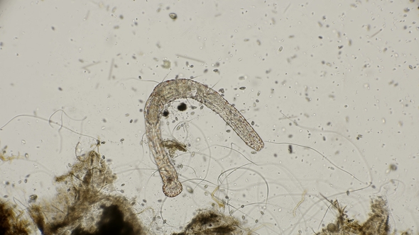 Worm of the Family Aeolosomatidae Aeolosoma Hemprichi Under the Microscope