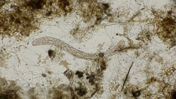 Worm of the Family Aeolosomatidae, Aeolosoma Hemprichi, Under the Microscope