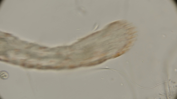 Worm of the Family Aeolosomatidae Aeolosoma Hemprichi Under the Microscope