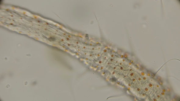 Worm of the Family Aeolosomatidae, Aeolosoma Hemprichi, Under the Microscope