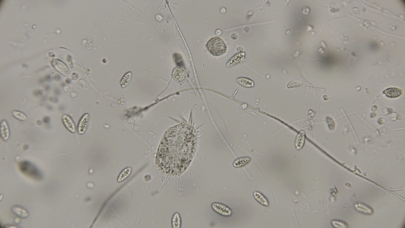 a Large Colony of Various Protozoa Under a Microscope