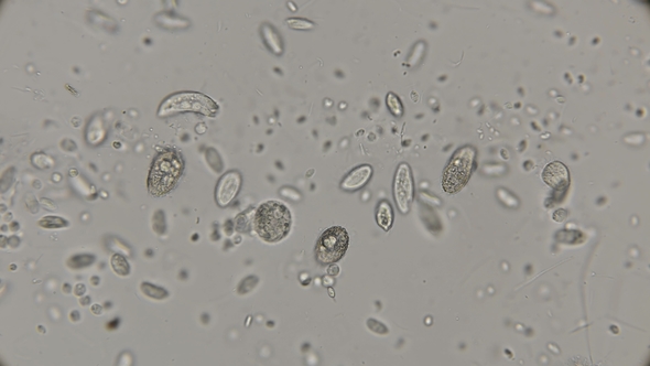 a Large Colony of Various Protozoa Under a Microscope