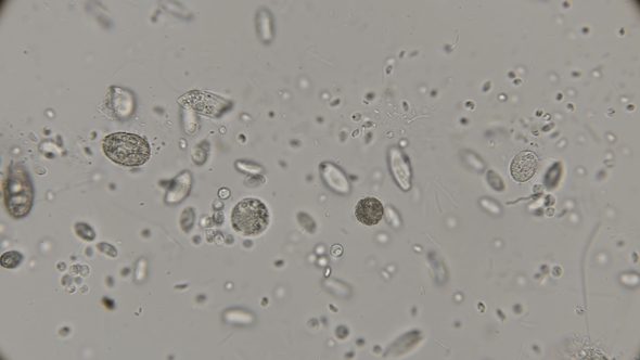 Accelerated Movement of a Large Colony of Various Protozoa Under a Microscope