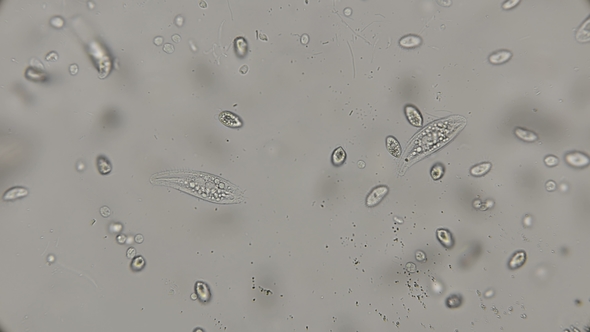 a Large Colony of Various Protozoa Under a Microscope