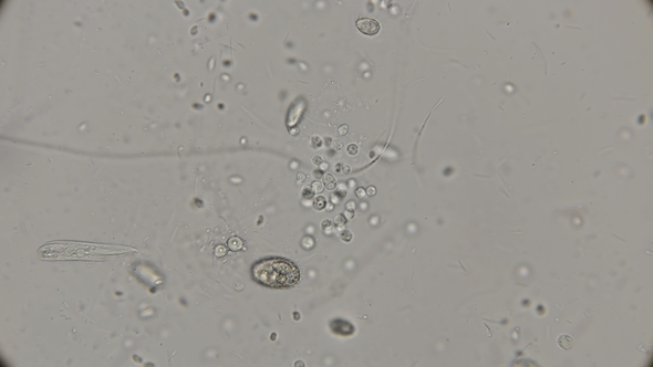 a Large Colony of Various Protozoa Under a Microscope