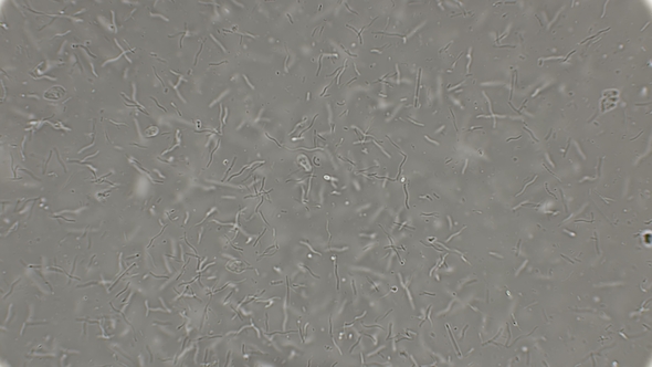 Colony of Bacteria Spirochetes Under a Microscope