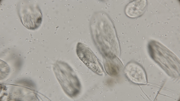 A Colony of Ciliates Stylonychia and Vorticella Under a Microscope