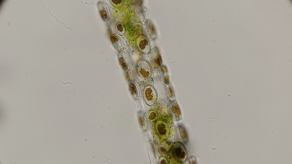 Diatoms Cocconeis Fixed on Filamentous Algae, Under a Microscope