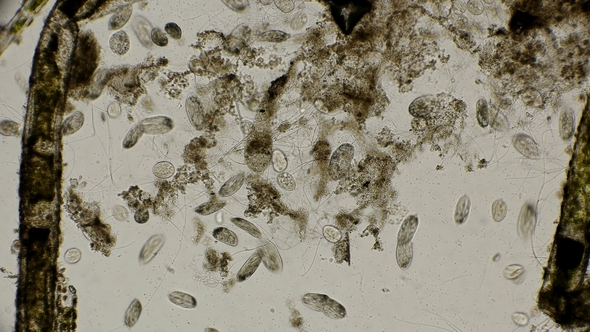 a Colony of Different Types of Infusorians Moving in Search of Food, Under a Microscope