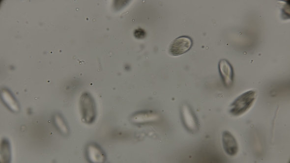 a Large Colony of Paramecium Putrinum Infusoria Inhabiting Waters with Oxygen Deficiency, Under a alt