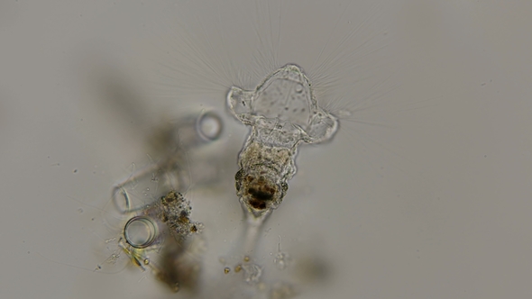 Rotifer Is Kind of Like a Genus of Collotheca Ornata, Under a Microscope