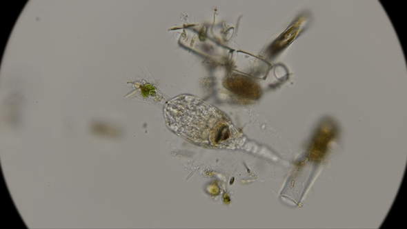 Rotifer Is Kind of Like a Genus of Collotheca Ornata, Under a Microscope